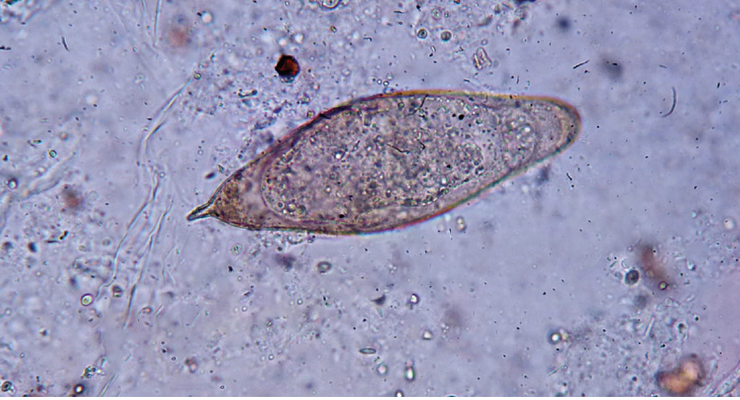 Curso Pós-Graduado de Atualização em Parasitologia Clínica – Morfologia Parasitária Humana