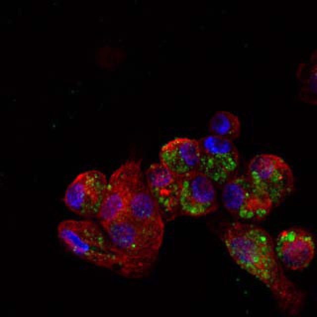 Nanovacinas capturadas por células dendríticas em cultura. Figura incluída no artigo publicado na revista Nature Nanotechnology, DOI: 10.1038/s41565-019-0512-0 https://www.nature.com/articles/s41565-019-0512-0